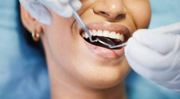 Best Emergency Dentist for Knocked-Out Tooth in Carrollton, VA