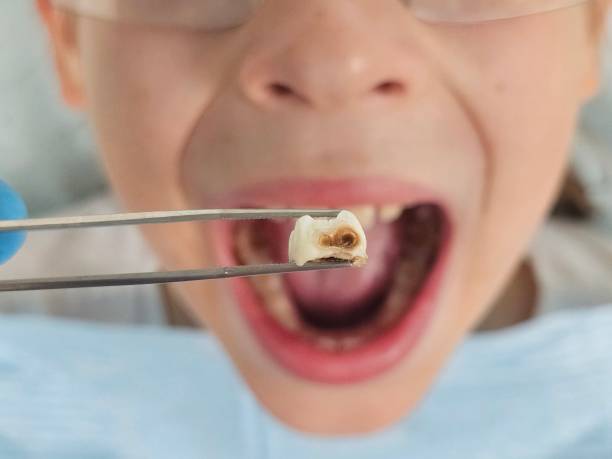 Best Emergency Dental Services for Seniors in Carrollton, VA