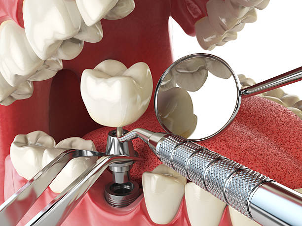 Best Orthodontic Emergency Dentist in Carrollton, VA